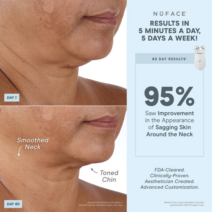 NuFace® TRINITY + Starter Kit | Smart Advanced Facial Toning Kit