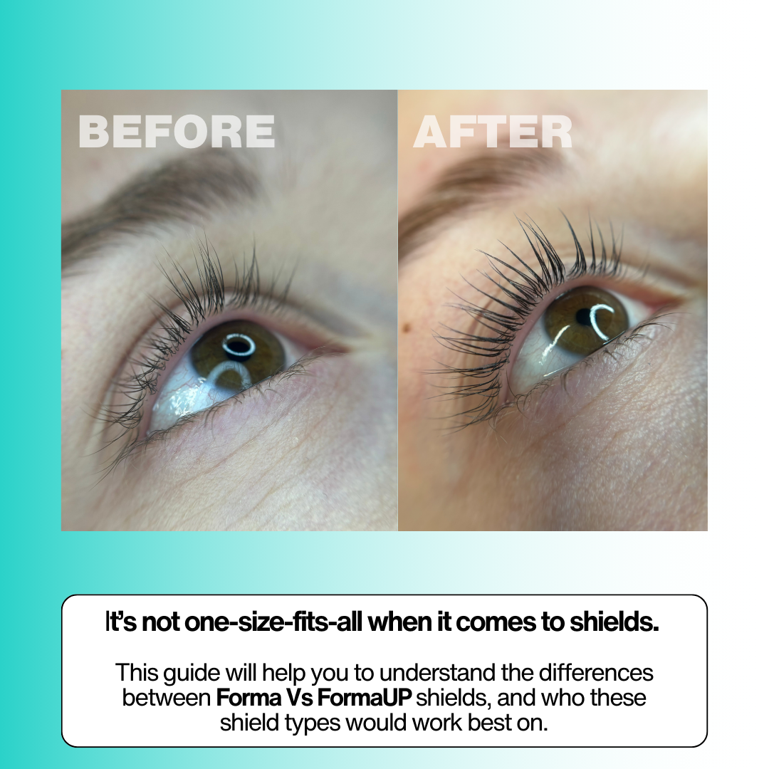 Forma Vs FormaUP (PDF)