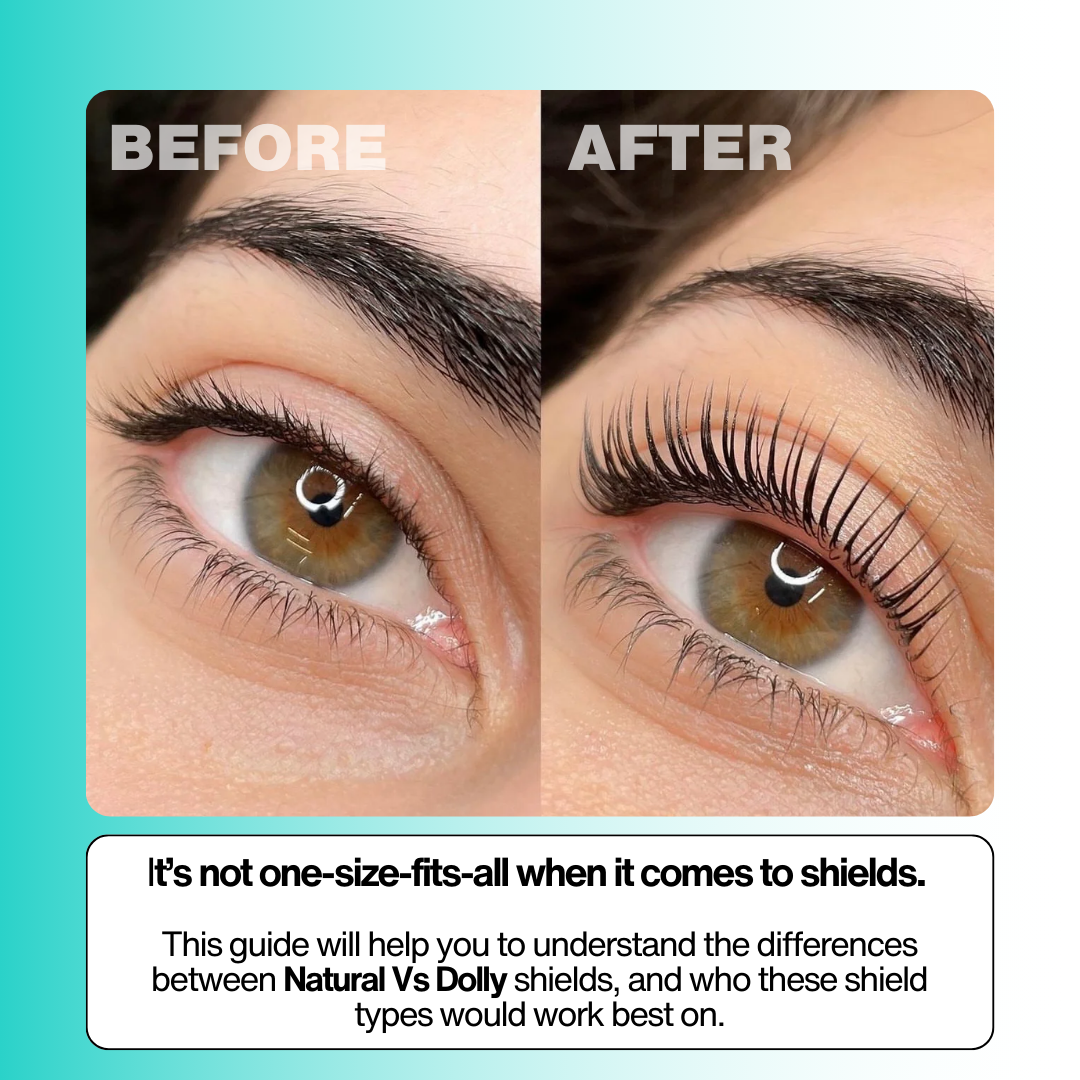 Dolly Vs Natural Shield (PDF)