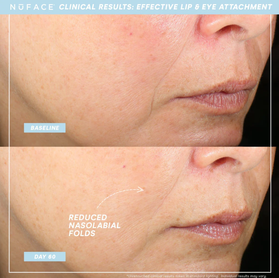 NuFace® TRINITY + PRO Lip & Eye Attachment